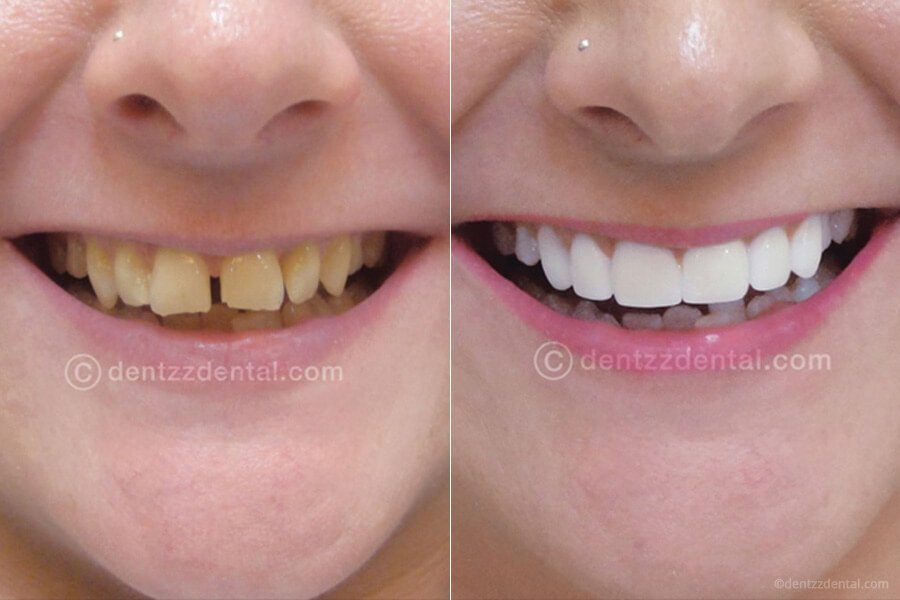 Dentzz Dental