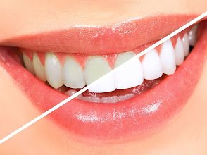 Dr. Khosla's Dental Clinic