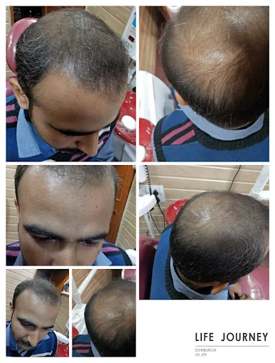 Dr Akhilesh verma